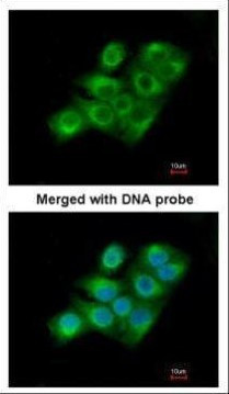 Factor XIII A Antibody in Immunocytochemistry (ICC/IF)