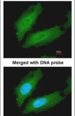 MURF1 Antibody in Immunocytochemistry (ICC/IF)
