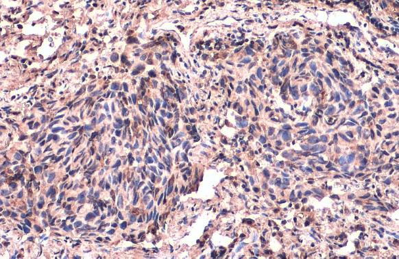 CD74 Antibody in Immunohistochemistry (Paraffin) (IHC (P))