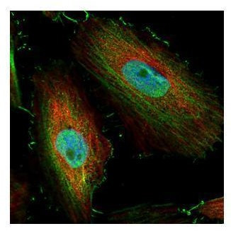BIVM Antibody in Immunocytochemistry (ICC/IF)
