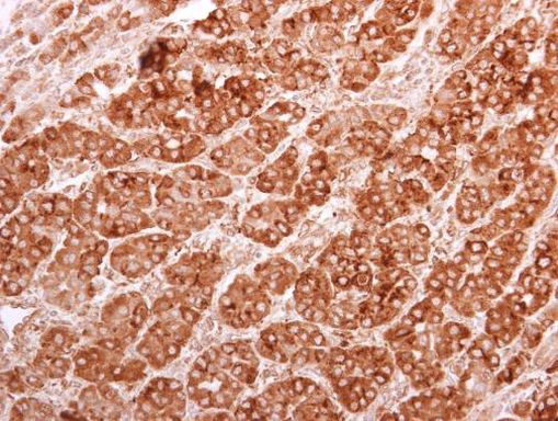 eIF5A2 Antibody in Immunohistochemistry (Paraffin) (IHC (P))