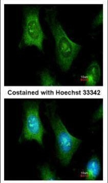 PTS Antibody in Immunocytochemistry (ICC/IF)