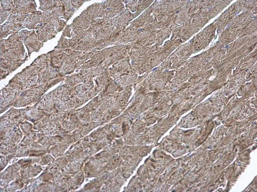 V-ATPase H Antibody in Immunohistochemistry (Paraffin) (IHC (P))