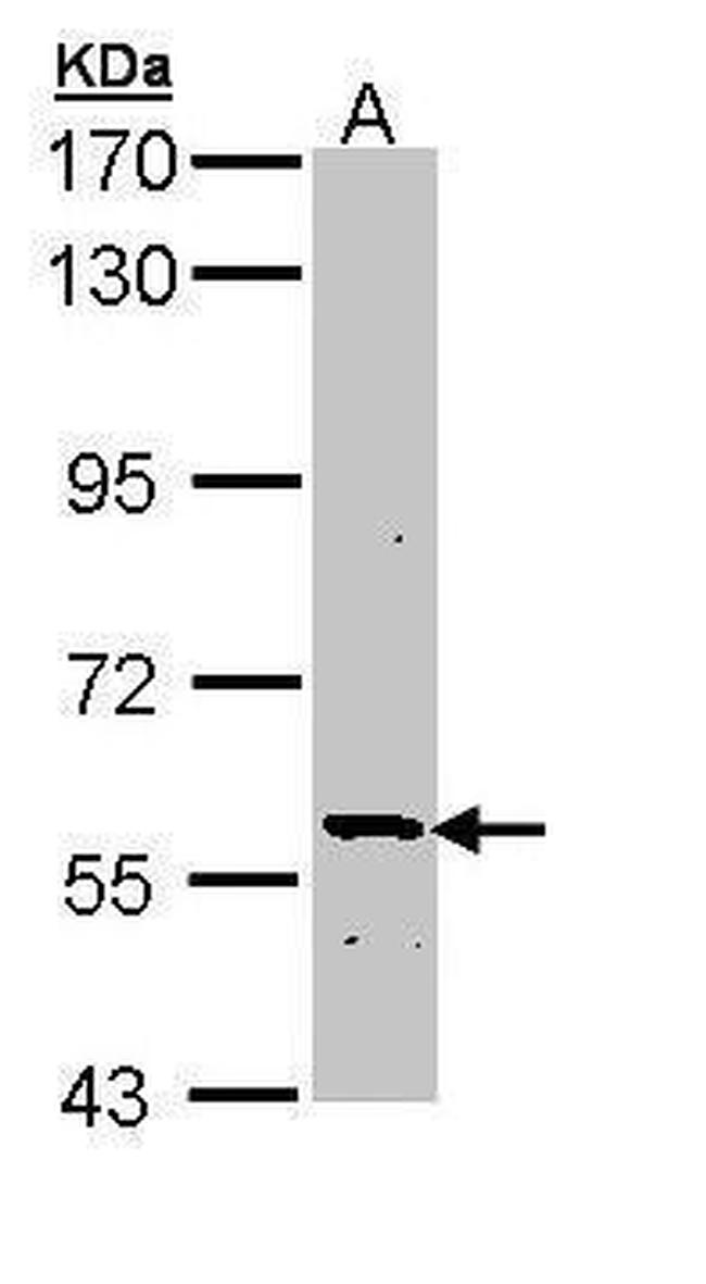 PLA2G3 Antibody in Western Blot (WB)