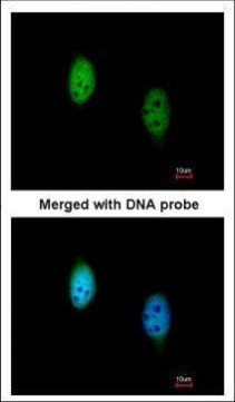TBLR1 Antibody in Immunocytochemistry (ICC/IF)