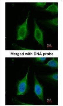 PPA1 Antibody in Immunocytochemistry (ICC/IF)