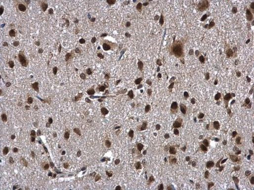 ZNF346 Antibody in Immunohistochemistry (Paraffin) (IHC (P))
