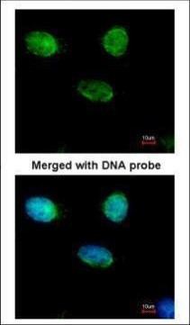 MCM3 Antibody in Immunocytochemistry (ICC/IF)