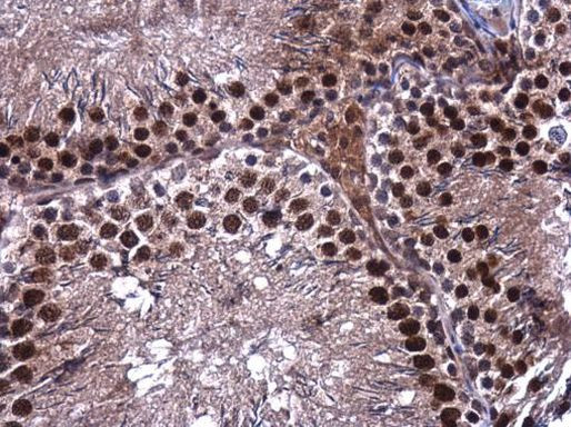 PIK3CB Antibody in Immunohistochemistry (Paraffin) (IHC (P))