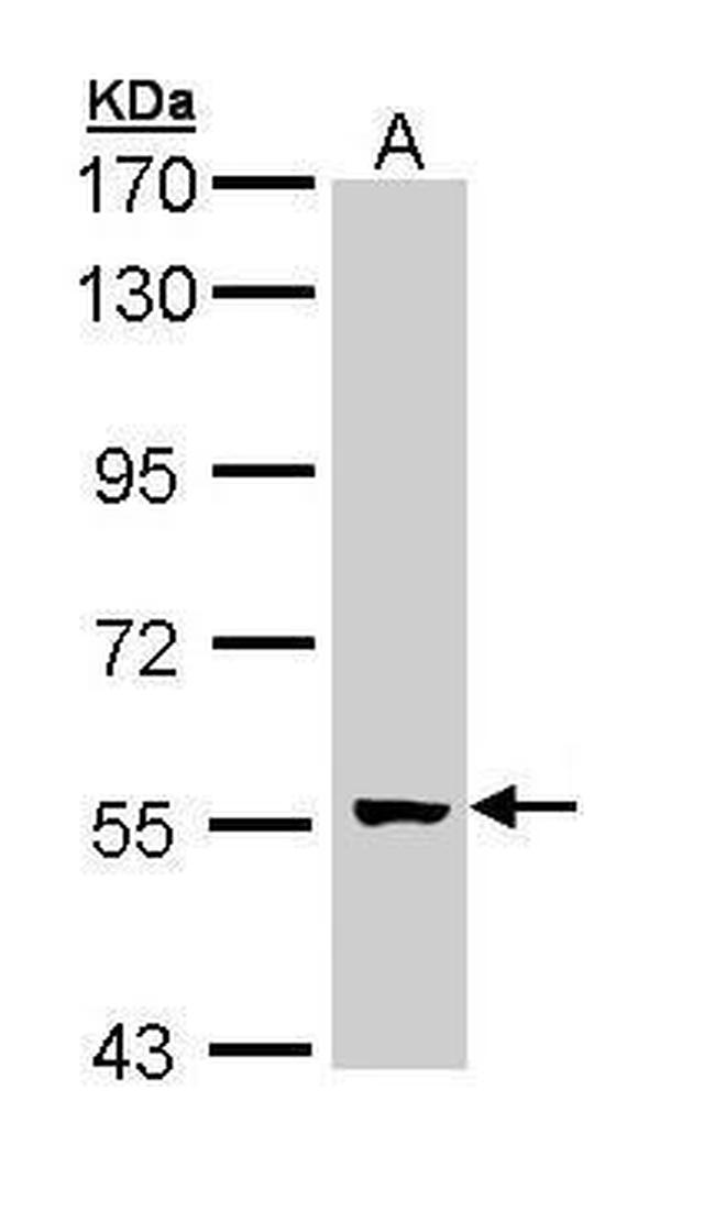 GCM2 Antibody in Western Blot (WB)