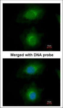 MVD Antibody in Immunocytochemistry (ICC/IF)