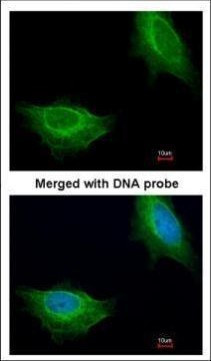 ADCK1 Antibody in Immunocytochemistry (ICC/IF)