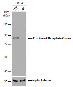 PFKM Antibody in Western Blot (WB)