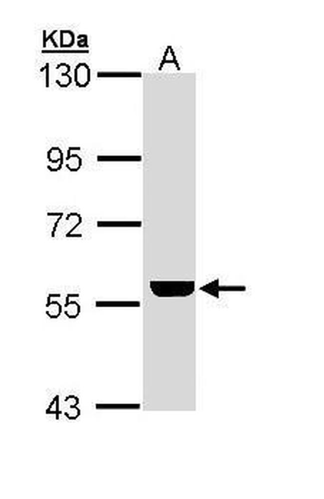 ADCK4 Antibody in Western Blot (WB)