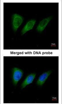 PKN2 Antibody in Immunocytochemistry (ICC/IF)