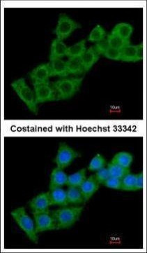 CHP1 Antibody in Immunocytochemistry (ICC/IF)