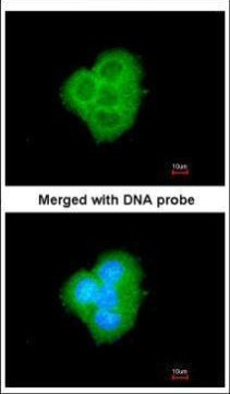 Bcl-B Antibody in Immunocytochemistry (ICC/IF)