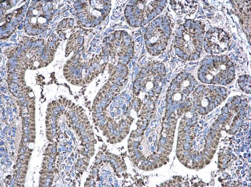 NDUFAB1 Antibody in Immunohistochemistry (Paraffin) (IHC (P))