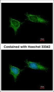 NDUFB5 Antibody in Immunocytochemistry (ICC/IF)