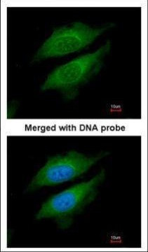 DPP8 Antibody in Immunocytochemistry (ICC/IF)