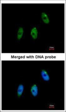 ELP3 Antibody in Immunocytochemistry (ICC/IF)