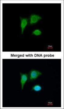 PIG3 Antibody in Immunocytochemistry (ICC/IF)