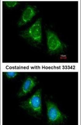 PAN3 Antibody in Immunocytochemistry (ICC/IF)