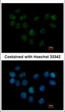 SMC1B Antibody in Immunocytochemistry (ICC/IF)