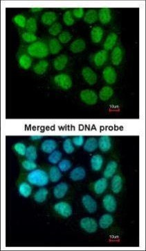 Cyclin T2 Antibody in Immunocytochemistry (ICC/IF)