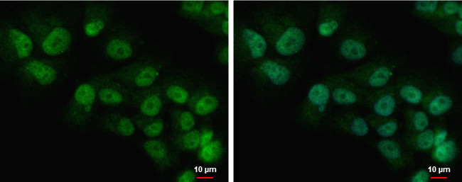 COMMD7 Antibody in Immunocytochemistry (ICC/IF)