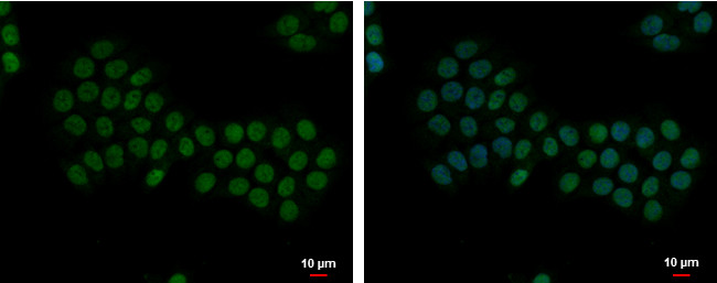 Apoptosis-Enhancing Nuclease Antibody in Immunocytochemistry (ICC/IF)