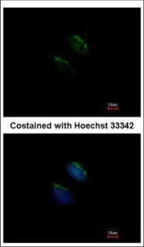 MGAT3 Antibody in Immunocytochemistry (ICC/IF)