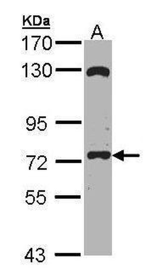 EXOC7 Antibody in Western Blot (WB)
