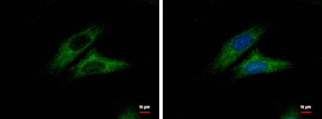 CTNNAL1 Antibody in Immunocytochemistry (ICC/IF)