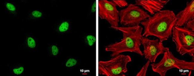 ZHX2 Antibody in Immunocytochemistry (ICC/IF)