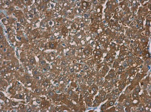 TRPM2 Antibody in Immunohistochemistry (Paraffin) (IHC (P))