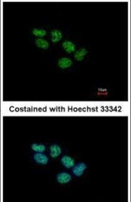 EED Antibody in Immunocytochemistry (ICC/IF)