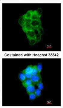 PPFIBP2 Antibody in Immunocytochemistry (ICC/IF)