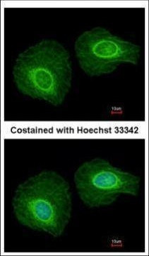Cytokeratin 34 Antibody in Immunocytochemistry (ICC/IF)