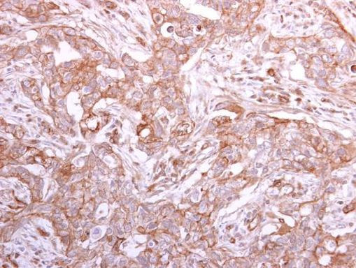GMDS Antibody in Immunohistochemistry (Paraffin) (IHC (P))