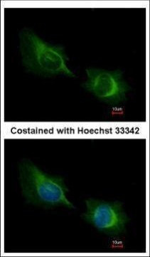 DTX1 Antibody in Immunocytochemistry (ICC/IF)