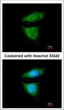 DYNC1I2 Antibody in Immunocytochemistry (ICC/IF)