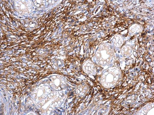 ITIH3 Antibody in Immunohistochemistry (Paraffin) (IHC (P))