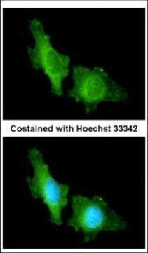 CNGA2 Antibody in Immunocytochemistry (ICC/IF)