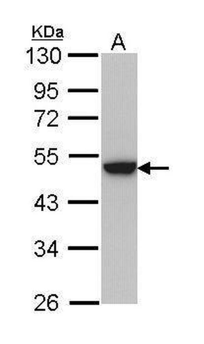 Cytokeratin 31 Antibody in Western Blot (WB)