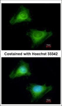 GBP3 Antibody in Immunocytochemistry (ICC/IF)