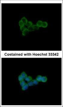 DLST Antibody in Immunocytochemistry (ICC/IF)