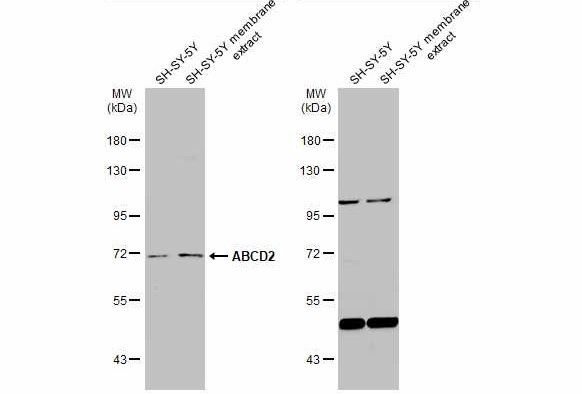 ABCD2 Antibody in Western Blot (WB)