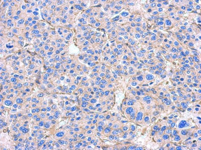 Alpha-Smooth Muscle Actin Antibody in Immunohistochemistry (IHC)