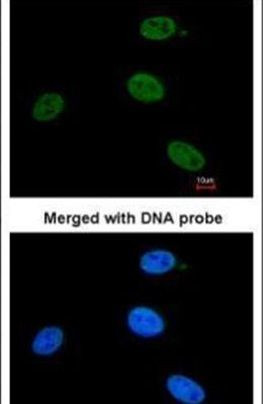 XPB Antibody in Immunocytochemistry (ICC/IF)